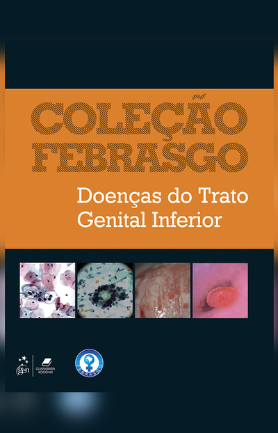 Bookplay Coleção Febrasgo Doenças do Trato Genital Inferior